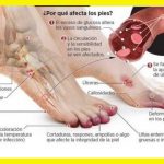 ¿Porque la diabetes afecta los pies? ✅